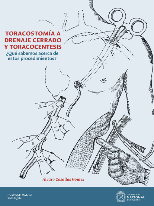 Title details for Toracostomía a drenaje cerrado y toracocentesis by Álvaro Casallas Gómez - Available